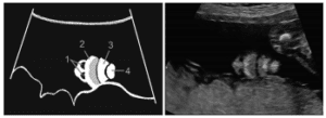 Figure 8