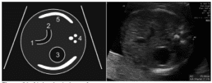 Figure 31