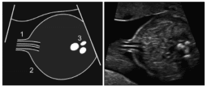 Figure 32