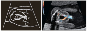 Figure 33