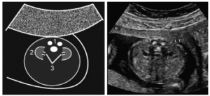 Figure 34
