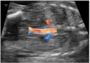 Figure 36