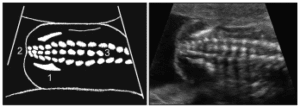 Figure 39