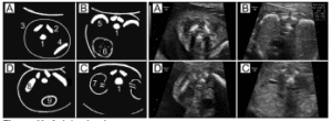 Figure 40