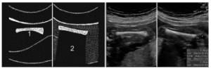 Figure 41