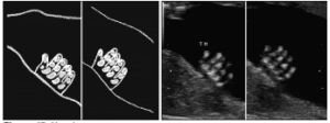 Figure 47